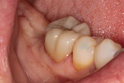 1709degan P05dig 1709degan P05dig