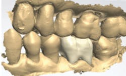 1709degan P06dig 1709degan P06dig