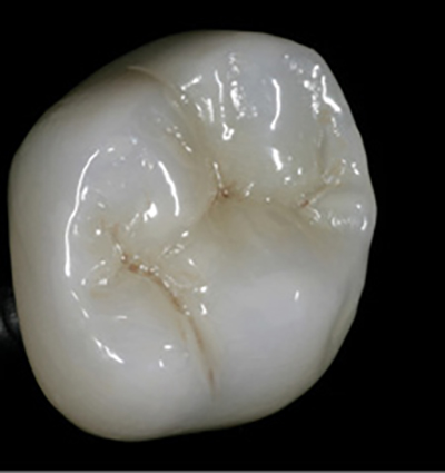 1709dehoo P01