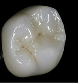 1709dehoo P01 1709dehoo P01