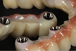 1709dehoo P03 1709dehoo P03