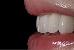 1709dehoo P06 1709dehoo P06