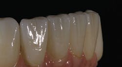 1709dehoo P07 1709dehoo P07