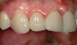 1709denas P02 1709denas P02