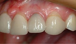 1709denas P03 1709denas P03