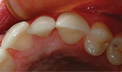 1709denas P05 1709denas P05