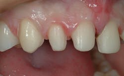 1709denas P06 1709denas P06