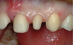 1709denas P07 1709denas P07