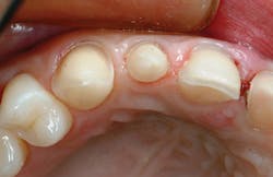 1709denas P08a 1709denas P08a