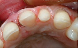 1709denas P08b 1709denas P08b