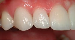 1709denas P09 1709denas P09