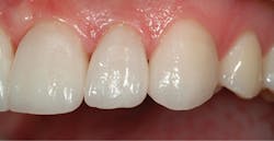 1709denas P10 1709denas P10