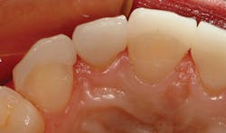 1709denas P11 1709denas P11