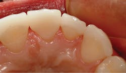 1709denas P12 1709denas P12