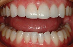 1709denas P13 1709denas P13