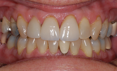 1710debra P10