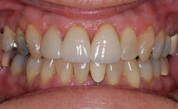 1710debra P10 1710debra P10