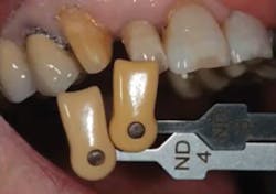 1710decon P03 1710decon P03