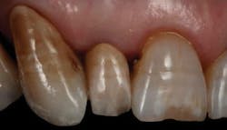 1710decon P04 1710decon P04