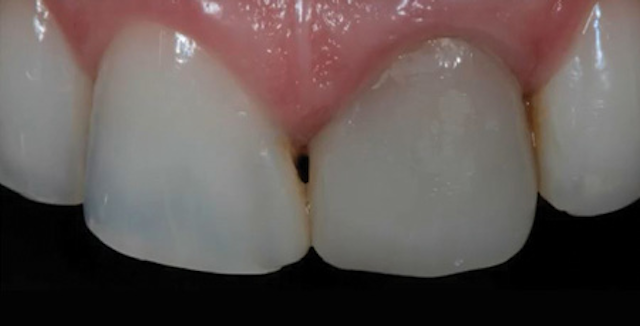 1710decon P06cropped