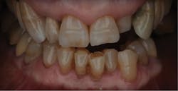 1710decon P08 1710decon P08