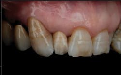 1710decon P09 1710decon P09