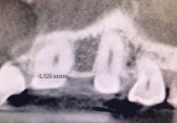 1710dekop P02 1710dekop P02