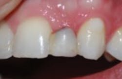 1710dekop P03 1710dekop P03