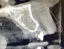 1710dekop P04 Figure 3 1710dekop P04 Figure 3