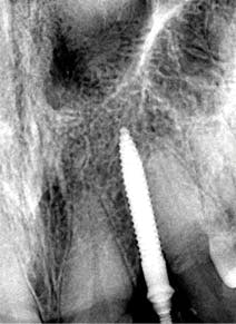 1710dekop P05 Figure 4 1710dekop P05 Figure 4