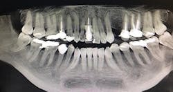 1710dekop P07 1710dekop P07