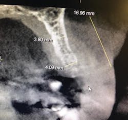 1710dekop P08 1710dekop P08