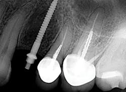 1710dekop P09 1710dekop P09