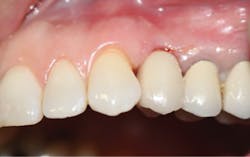 1710dekop P12 Figure 11 1710dekop P12 Figure 11