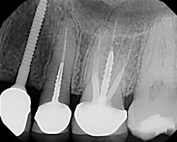 1710dekop P13 1710dekop P13