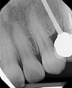 1710dekop P13x 1710dekop P13x