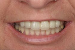 1710depec P01 1710depec P01