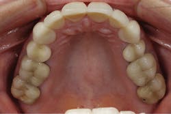 1710depec P03 1710depec P03