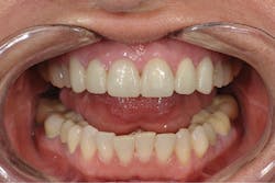 1710depec P05 1710depec P05