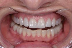 1710depec P07 1710depec P07