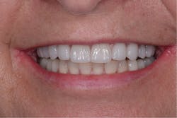 1710depec P08 1710depec P08