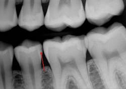 1711dechr P03 1711dechr P03