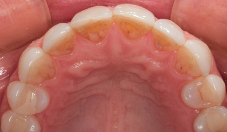 1711denas P02