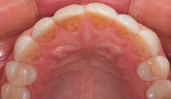 1711denas P02 1711denas P02