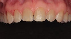 1711denas P03 1711denas P03