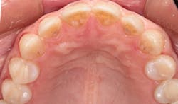 1711denas P04 1711denas P04