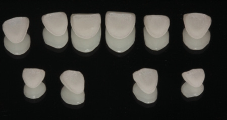 1711denas P05