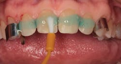 1711denas P07 1711denas P07