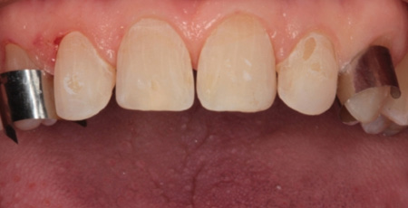 1711denas P08