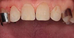 1711denas P08 1711denas P08